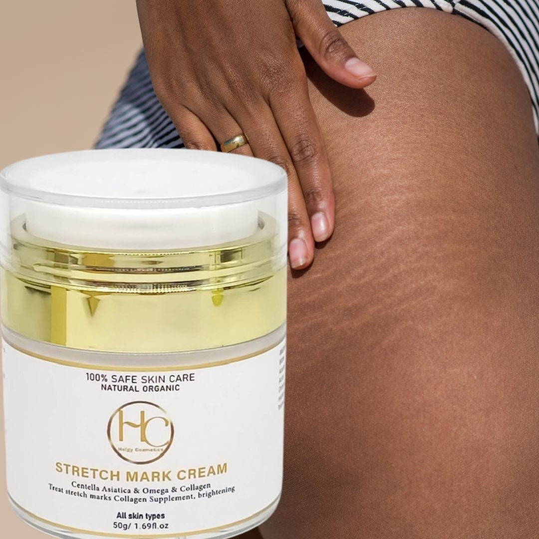 Crème Anti - Vergetures | STRETCH MARK CREAM