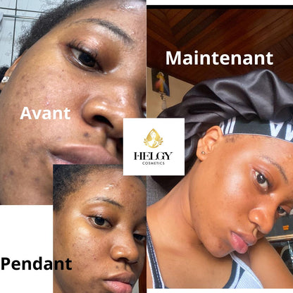 Gamme Visage Anti-Hyperpigmentation – Helgy COSMETICS