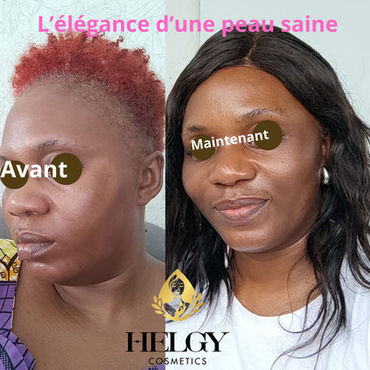 Gamme Visage Anti-Hyperpigmentation – Helgy COSMETICS